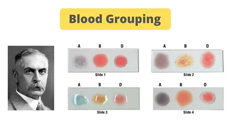 blood grouping principle  procedure