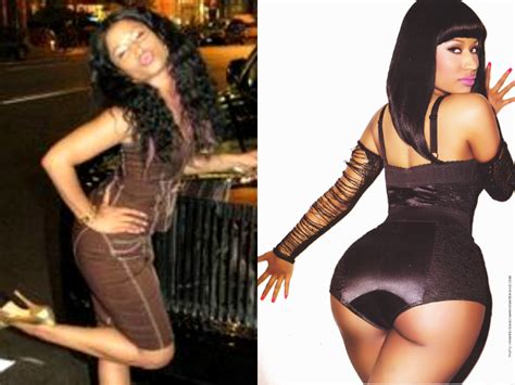pictures celebrities with fake body parts nicki minaj butt before and after