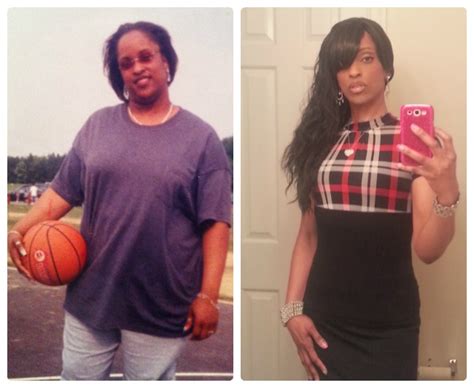 Member Spotlight Weight Loss Surgery Before And After