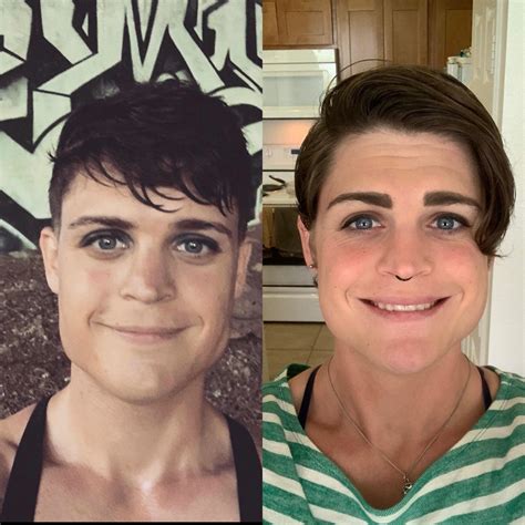 facial   month hrt  months hrt rtranstimelines