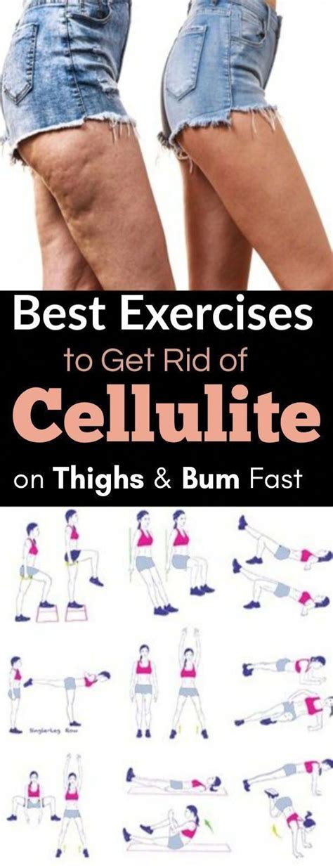 pin  permanent cellulite removal