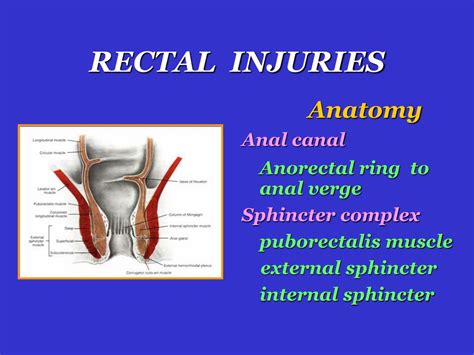 ppt colon and rectum injuries powerpoint presentation free download