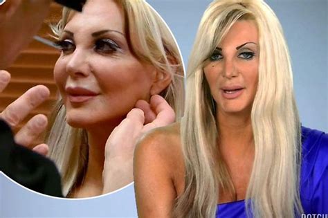 Human Barbie Doll Refused More Surgery As She Takes 10