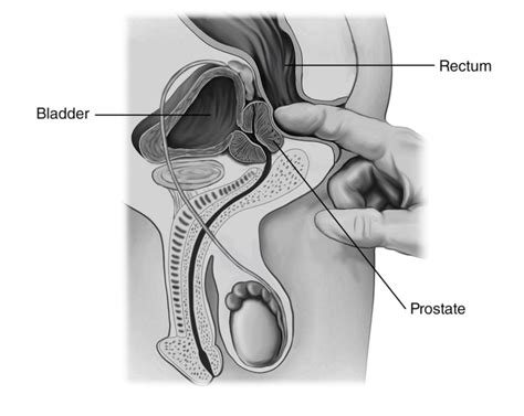 healthy prostate archives best in corporate health