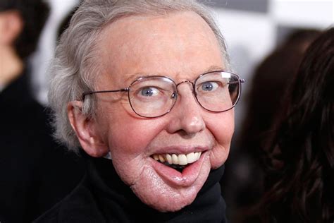 roger ebert jaw replacement