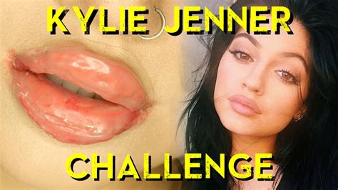 How To Do The Kylie Jenner Challenge Safely [warning Graphic Content