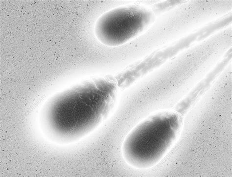 human sperm cells sem stock image p624 0147 science photo library