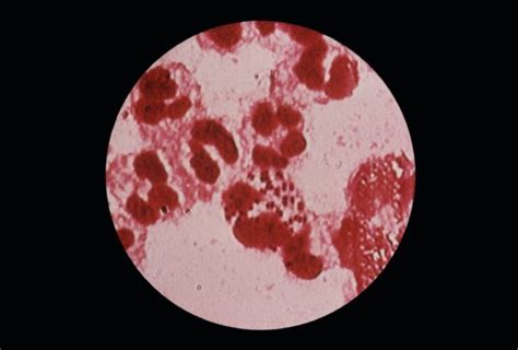 Free Picture Photomicrograph Gram Negative Bacteria Neisseria