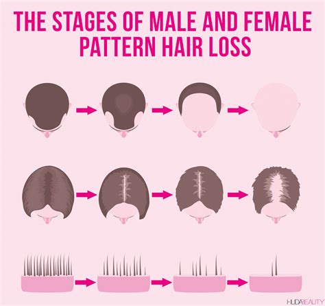 hair loss  signs    hair loss treatments blog huda beauty