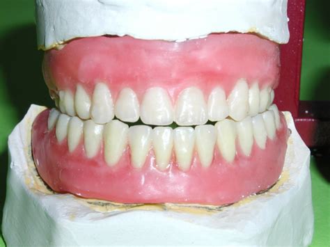 kunstgebit tandarts  deventer de   tandartsen en orthodontie