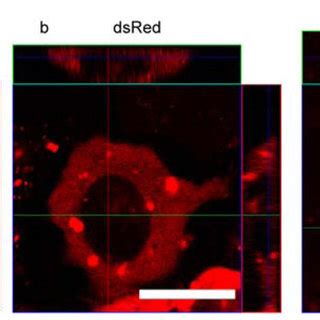 large fluorescent protein dsred accumulated   nucleus   scientific diagram