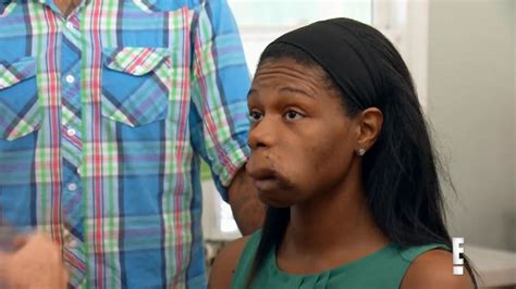 woman s agony as mouth becomes so deformed she chews on her own skin as