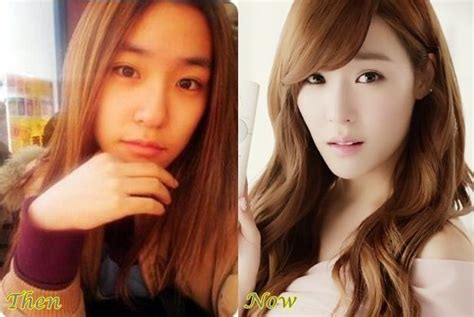 Tiffany Snsd Plastic Surgery Before And After Photos