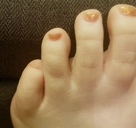 heck      tiny pinky toe nails     polish
