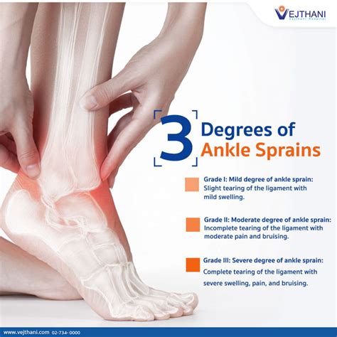 degrees  ankle sprains