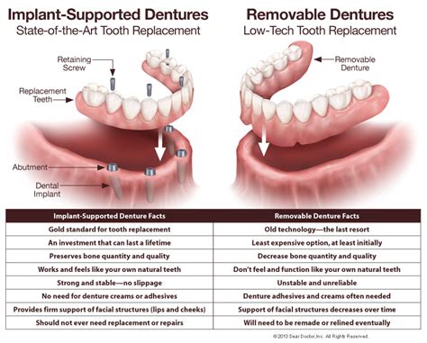 fixed dentures perfect  smile dental group chagrin falls
