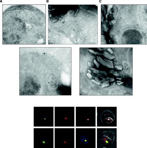 ae localization  pflpl  immune electron microscopy ultra thin  scientific