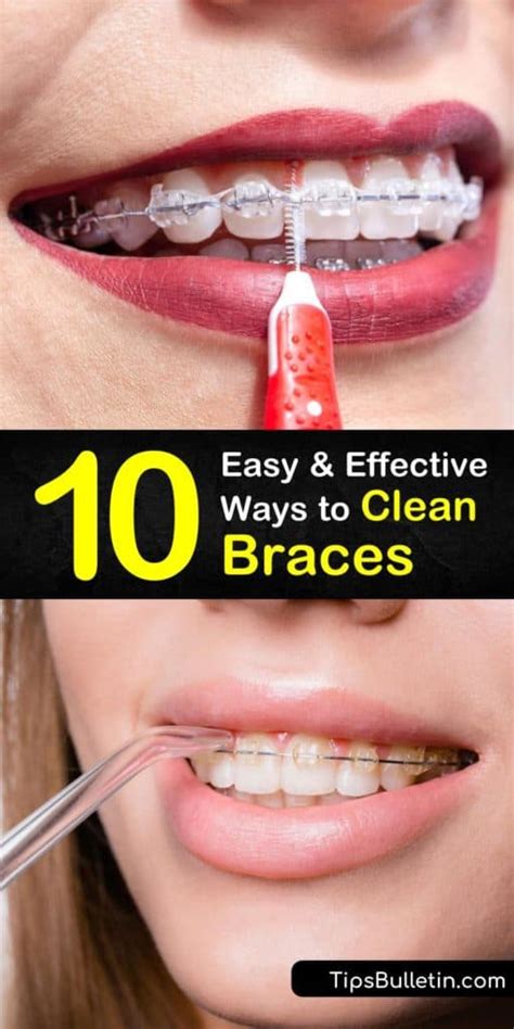 easy  effective ways  clean braces