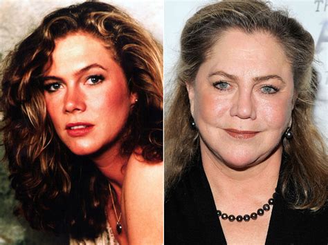 10 Shocking Celebrity Transformations