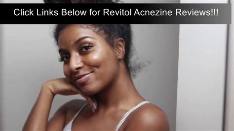 Best Pimple Cream For Women Revitol Acnezine Cream