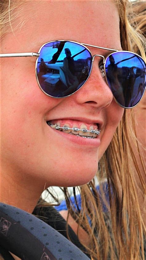 pin by larry greenstein on braces girls dental braces braces rubber