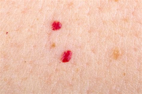 tiny red dots   skin   scary symptoms