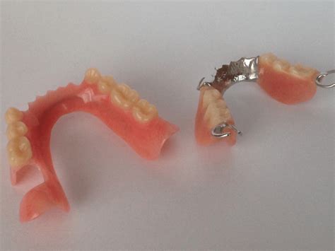 prothese dentaire partielle sirois denturologistes