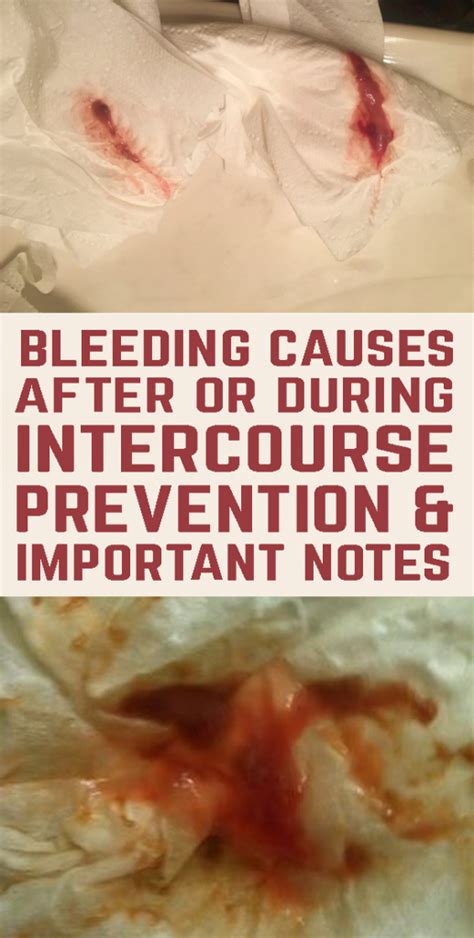 Bleeding Causes After Or During Intercourse Prevention