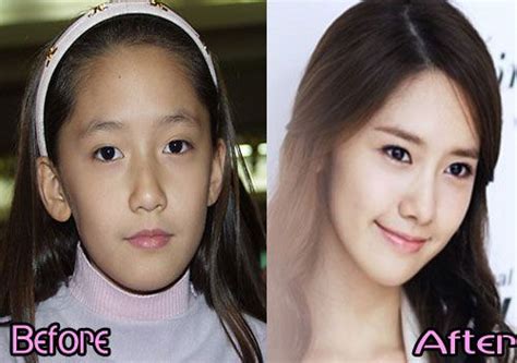 Snsd Plastic Surgery Before And After Snsd 2020