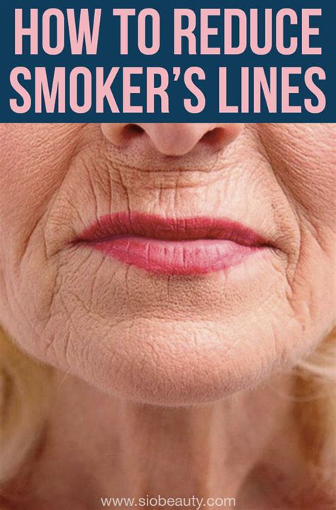how to get rid of smoker s lines easy steps for smooth lips