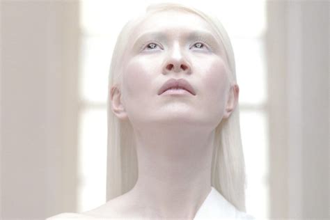 World’s First Albino Model Connie Chiu On Growing Up In Kowloon And
