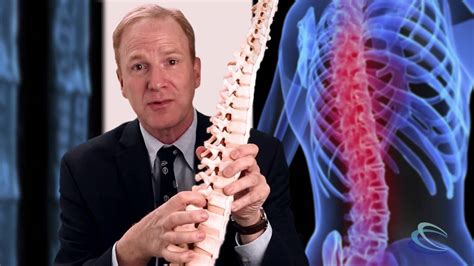 spinal nerve root pain youtube