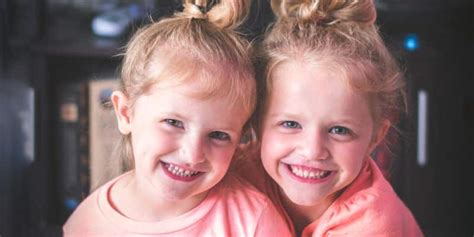 fun facts about twins alphabiolabs