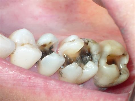 common dental problems platinum dental surgery