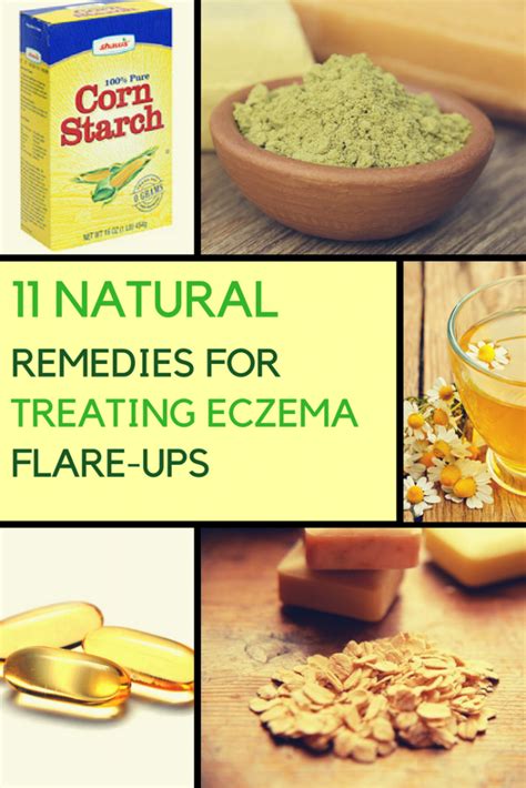 natural remedies  eczema      work
