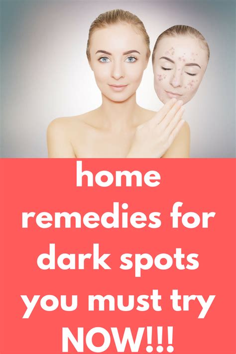 home remedies for dark spots you must try now with images black