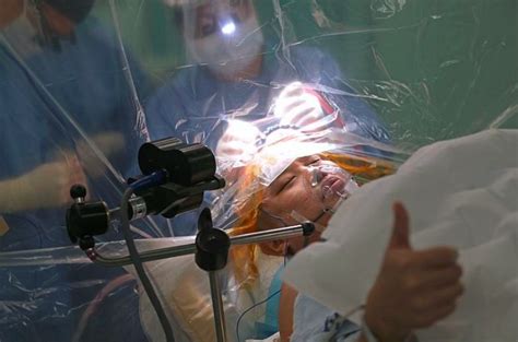 brain surgery  hes awake patient  zhi long   thumbs