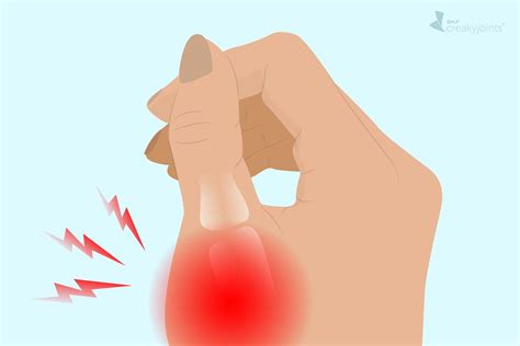 gout   thumb symptoms  treatments