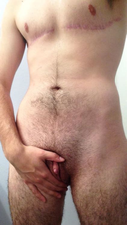 Transgender Man Nude