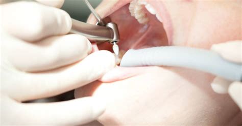 tandartsen ontkennen prijsstijging gezond adnl