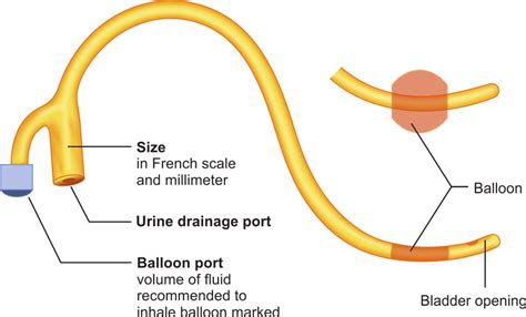 parts  foley catheter  scientific diagram