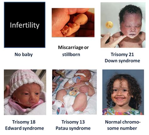 Chromosome Non Disjunction Examples Of Trisomy Indiegogo Lesson