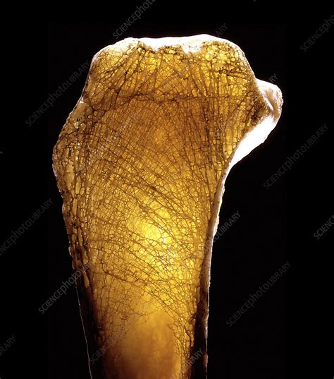 bone stock image p science photo library