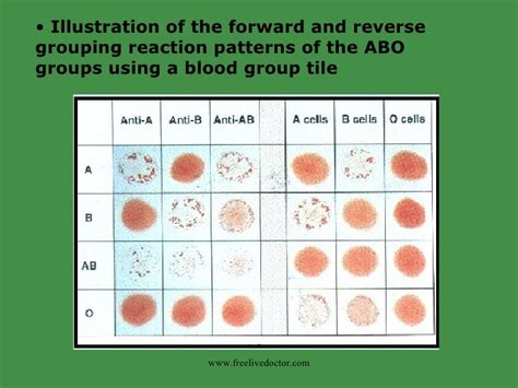 reverse blood grouping microplates blood groups aborhd reverse grouping
