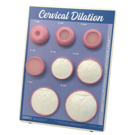 cervical effacement dilation chart childbirth graphics