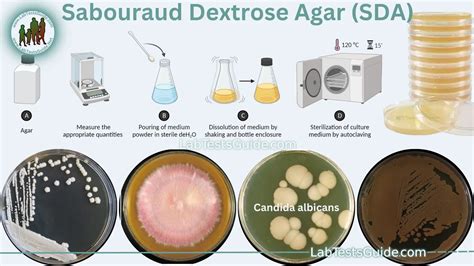 sabouraud dextrose  sda purpose principles procedure
