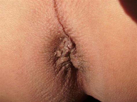 butt hole close up