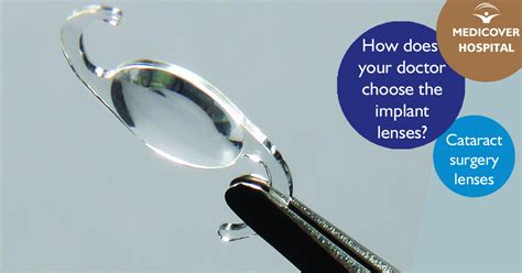 doctor choose   implant lenses   cataract