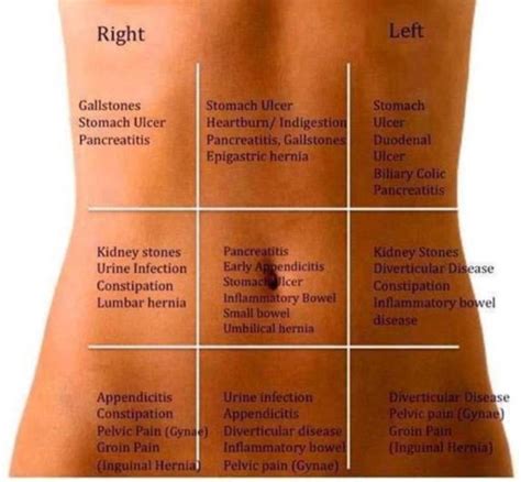 bol  trbuhu mapa otkriva sto bi moglo biti po mjestu bolova prirodom  zdravlja