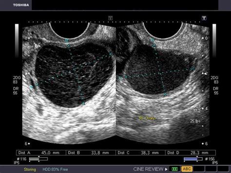 a gallery of high resolution ultrasound color doppler and 3d images